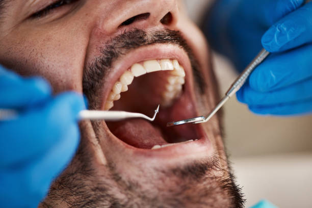 Best Emergency Gum Treatment in Maple Grove, MN