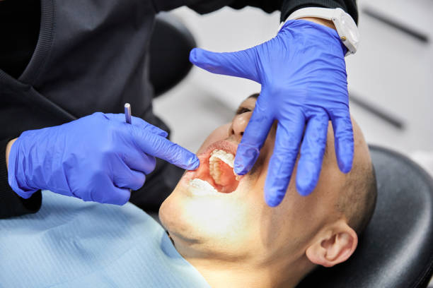 Best Emergency Tooth Extraction in Maple Grove, MN